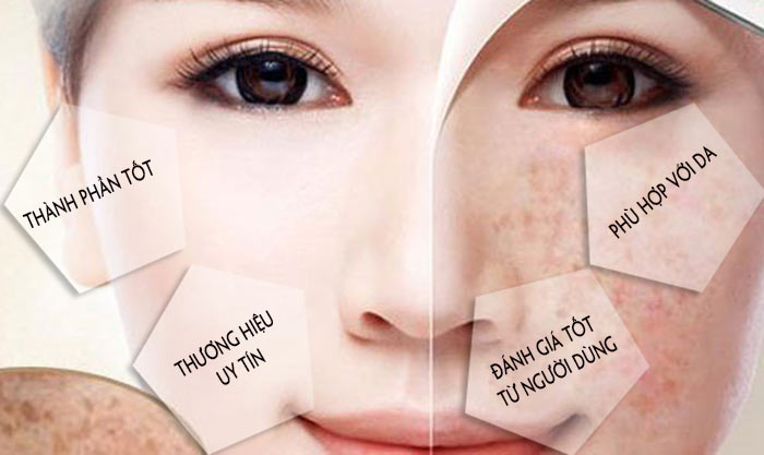 Review_ 6_dong_ kem_ tri_ nam_ Thai_ Lan_ tot_ nhat_ hien_ nay